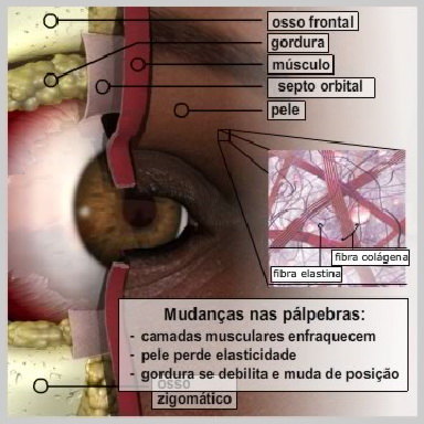 Blefaroplastia-Pálpebras-Superiores-O-QUE-PROVOCA-MUDANÇAS-NAS-PÁLPEBRAS