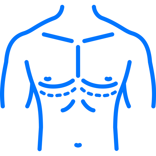 Gynecomastia_Icon