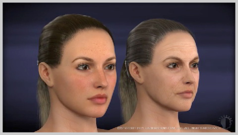 face-lift-lower-INTRODUTION