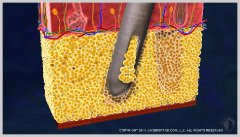 liposuction-PROCEDURE